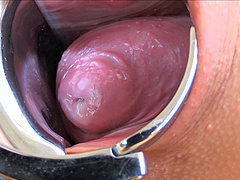 Look deep into her pussy thanks to the spreader