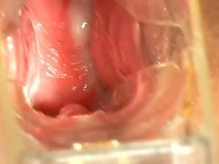 Even more for Ina that takes the whole baseball bat